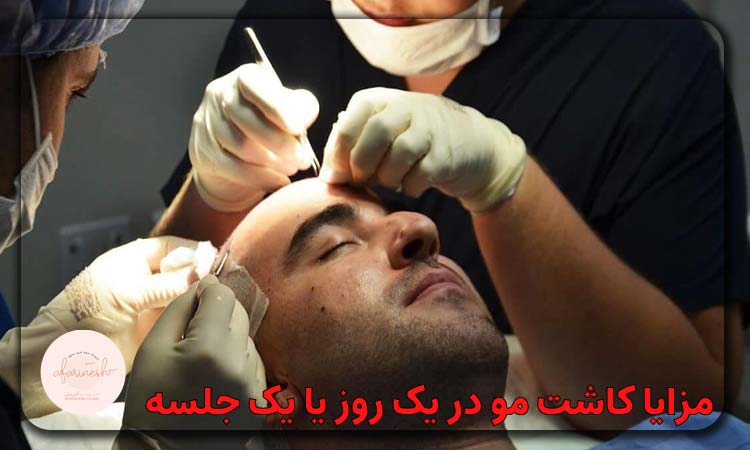 مزایا کاشت مو در یک روز یا یک جلسه