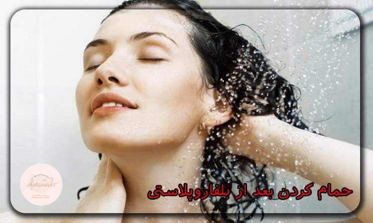 حمام کردن بعد از بلفاروپلاستی