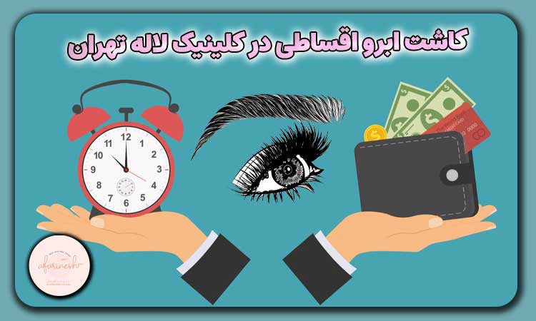 کاشت ابرو اقساطی در کلینیک لاله تهران
