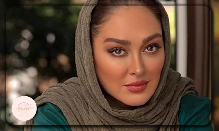 کاشت ابرو الهام حمیدی