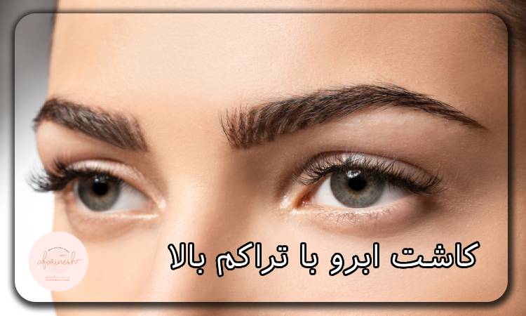 کاشت ابرو با تراکم بالا