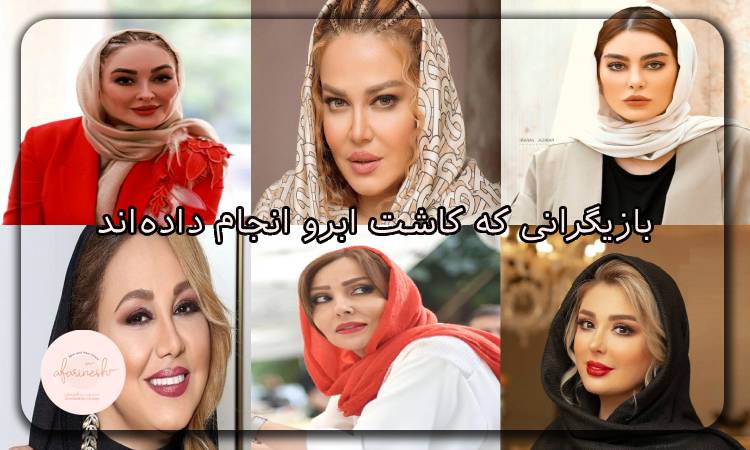 کاشت ابرو بازیگران