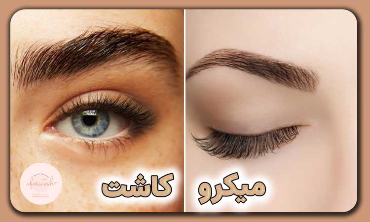 کاشت ابرو بهتره یا میکرو