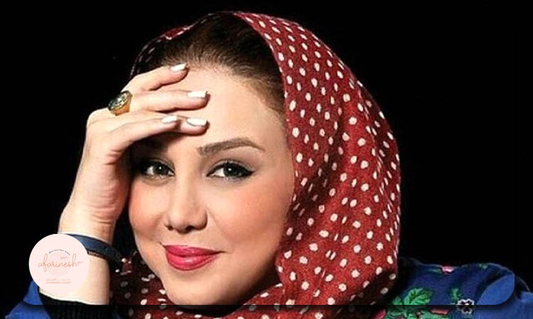 کاشت ابرو بهنوش بختیاری