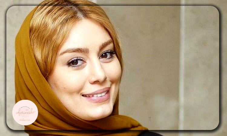 کاشت ابرو سحر قریشی
