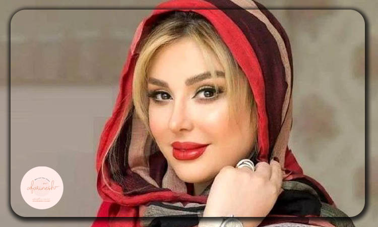 کاشت ابرو نیوشا ضیغمی