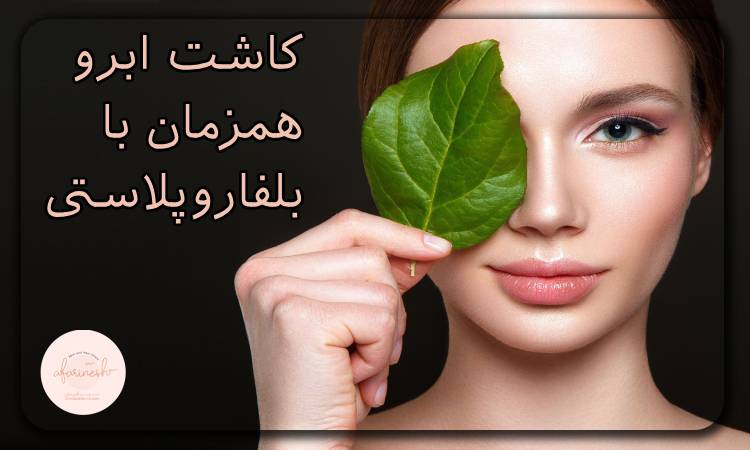 کاشت ابرو همزمان با بلفاروپلاستی
