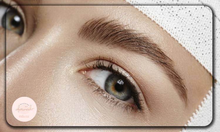 منظور از کاشت ابرو همزمان با بلفاروپلاستی چیست؟