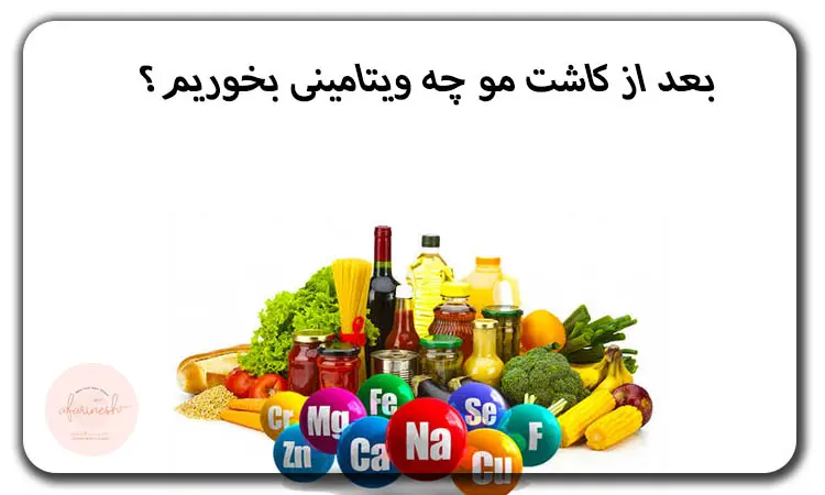 بعد از کاشت مو چه ویتامینی بخوریم؟