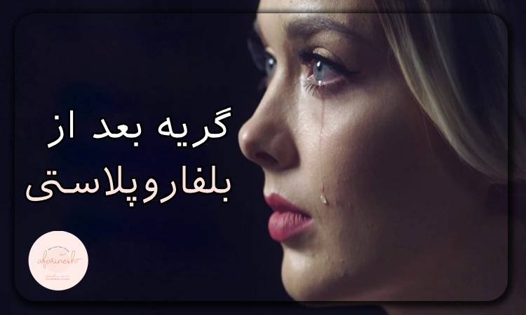 گریه بعد از بلفاروپلاستی