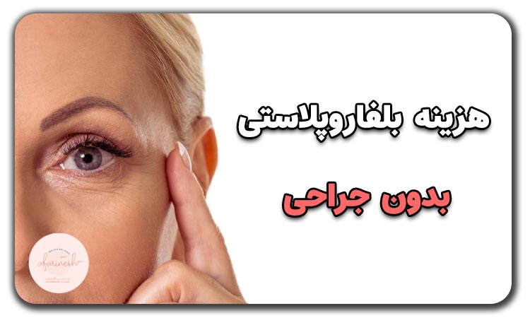 هزینه بلفاروپلاستی بدون جراحی