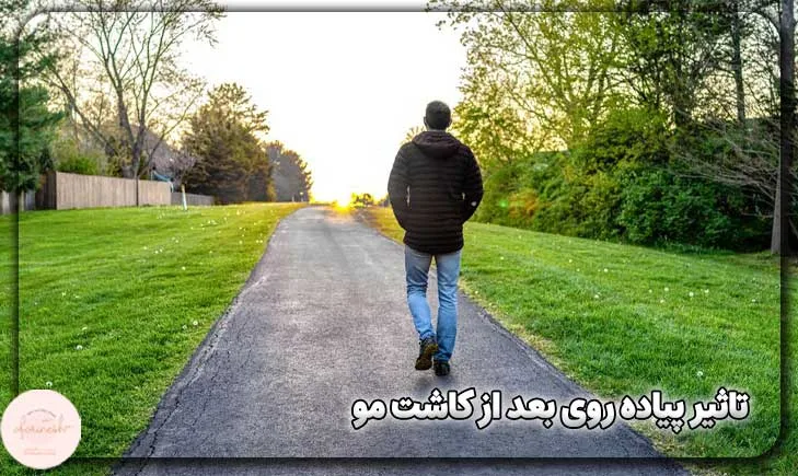 تاثیر پیاده روی بعد از کاشت مو