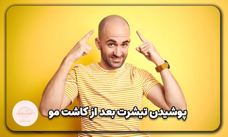 پوشیدن تیشرت بعد از کاشتن موها
