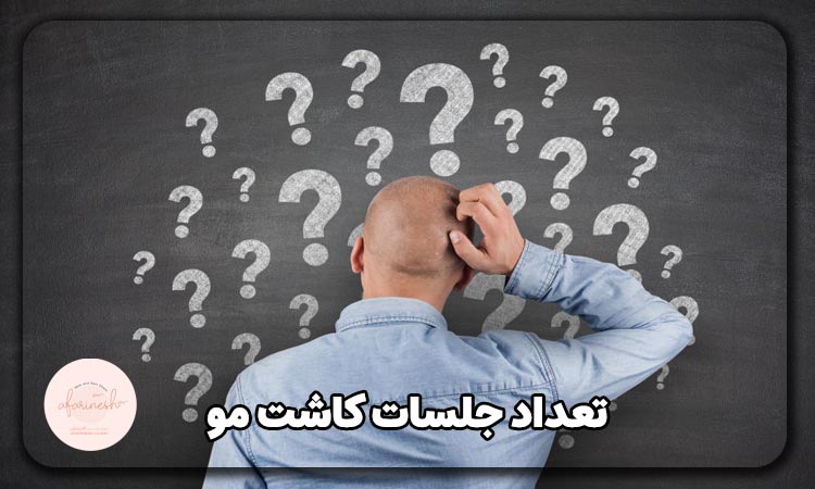تعداد جلسات کاشت مو