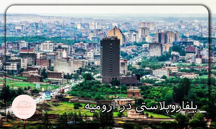 بلفاروپلاستی در ارومیه