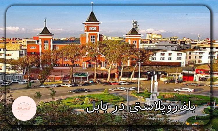 بلفاروپلاستی در بابل