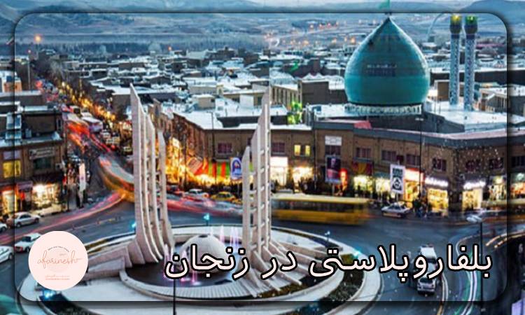 بلفاروپلاستی در زنجان