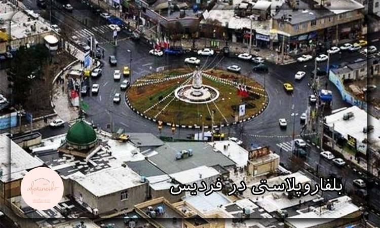 بلفاروپلاستی در فردیس