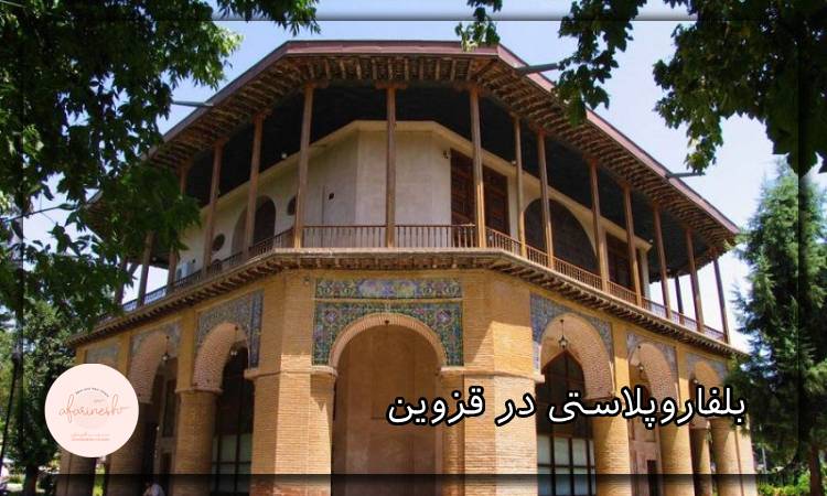 بلفاروپلاستی در قزوین