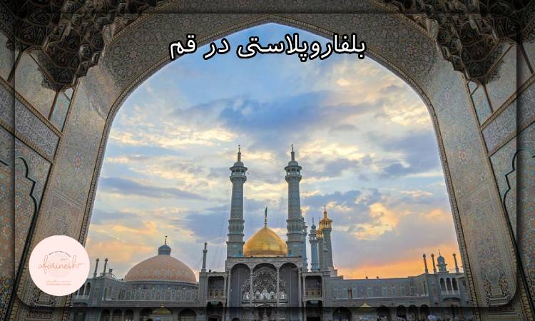 بلفاروپلاستی در قم
