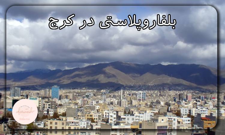 بلفاروپلاستی در کرج