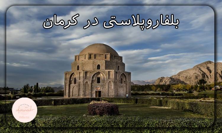 بلفاروپلاستی در کرمان