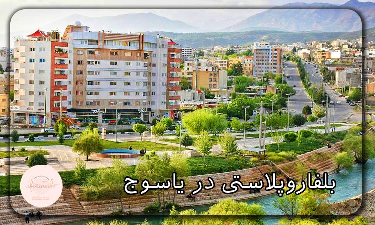 بلفاروپلاستی در یاسوج