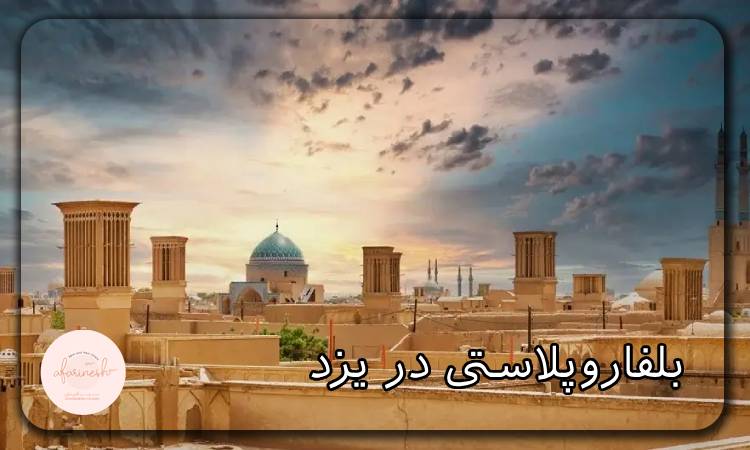 بلفاروپلاستی در یزد