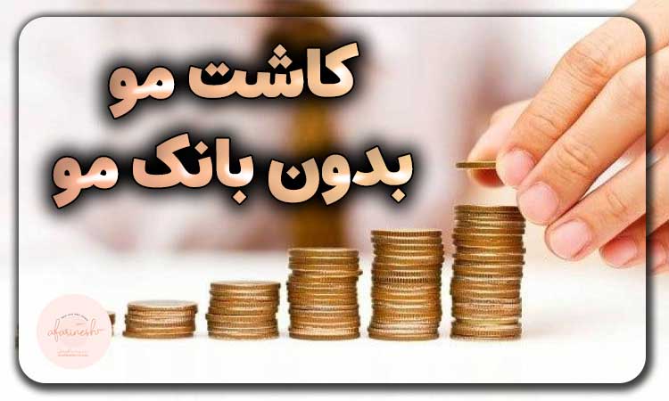 هزینه روش های کاشت مو بدون بانک مو
