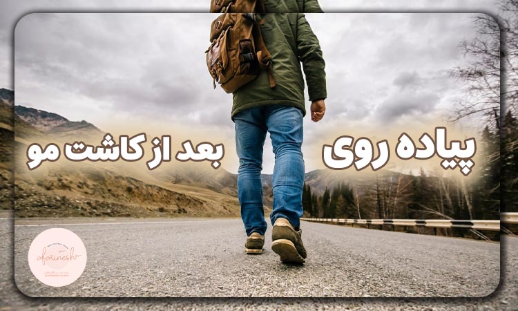 پیاده روی بعد از کاشت مو