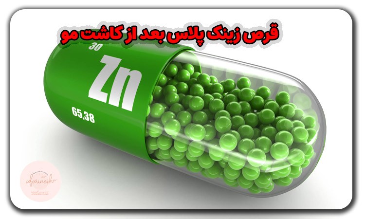 قرص زینک پلاس بعد از کاشت مو