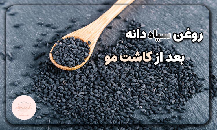 روغن سیاه دانه بعد از کاشت مو