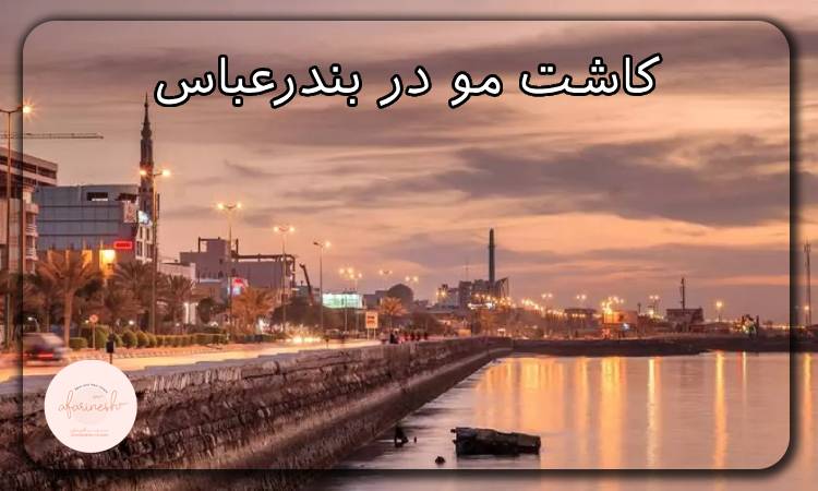 کاشت مو در بندرعباس