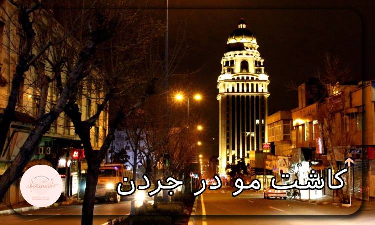 کاشت مو در جردن