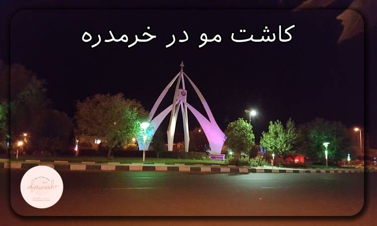 کاشت مو در خرمدره