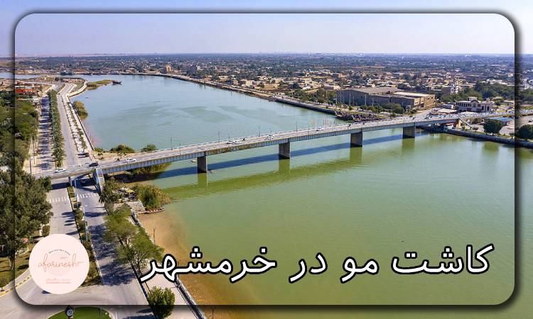کاشت مو در خرمشهر