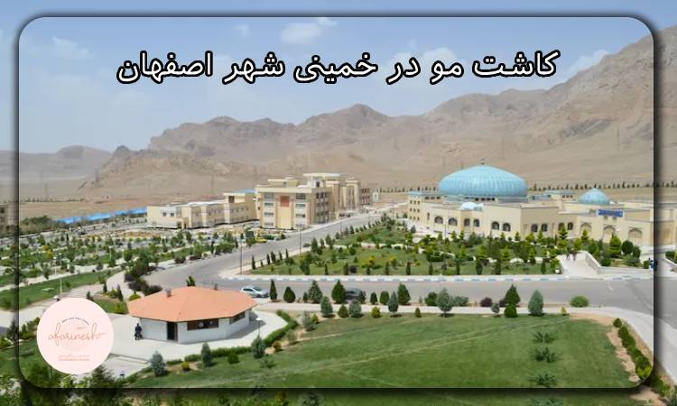 کاشت مو در خمینی شهر اصفهان