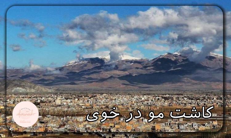 کاشت مو در خوی