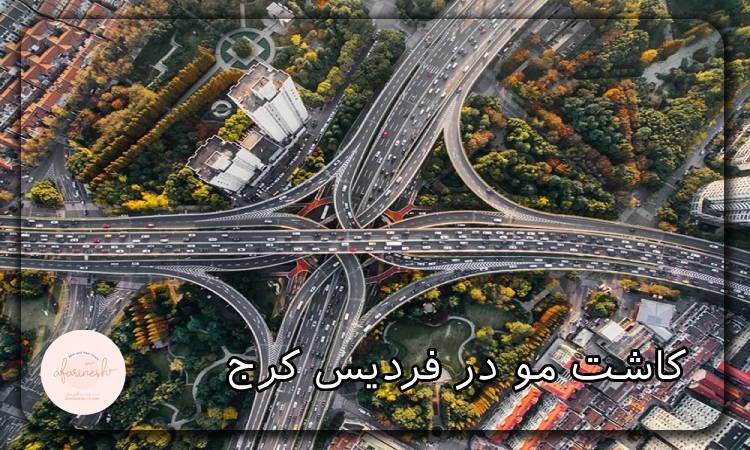 کاشت مو در فردیس کرج