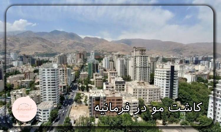 کاشت مو در فرمانیه