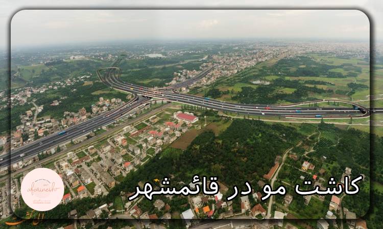 کاشت مو در قائمشهر