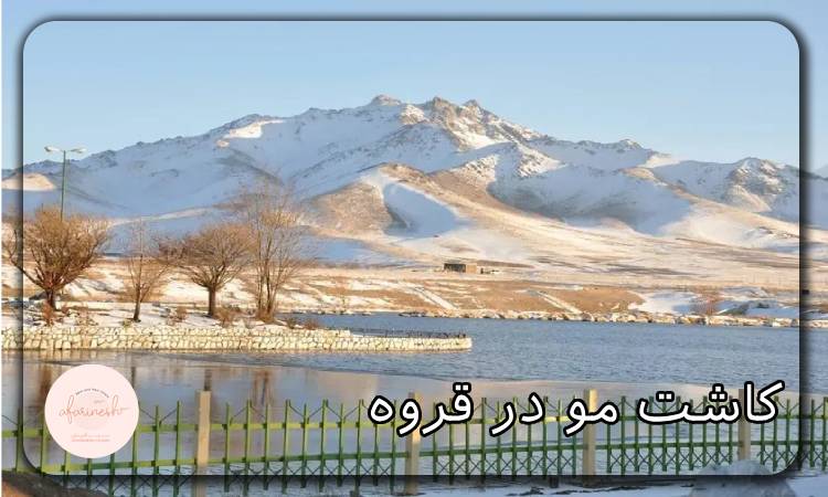 کاشت مو در قروه