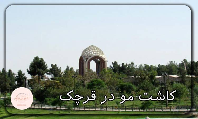 کاشت مو در قرچک