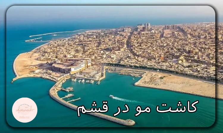 کاشت مو در قشم