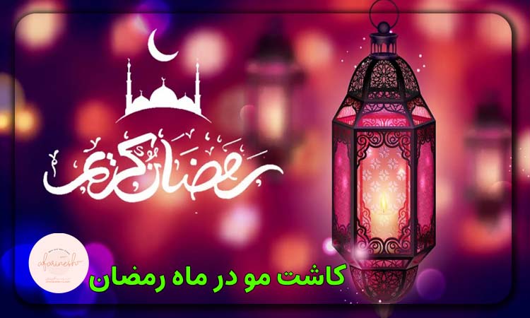 کاشت مو در ماه رمضان