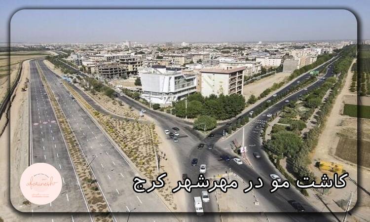 کاشت مو در مهرشهر کرج