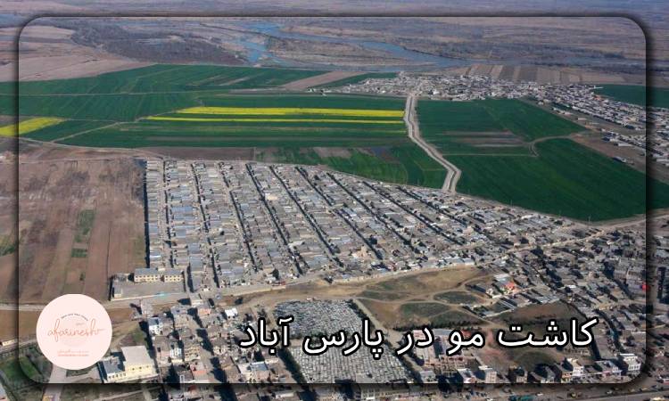 کاشت مو در پارس آباد