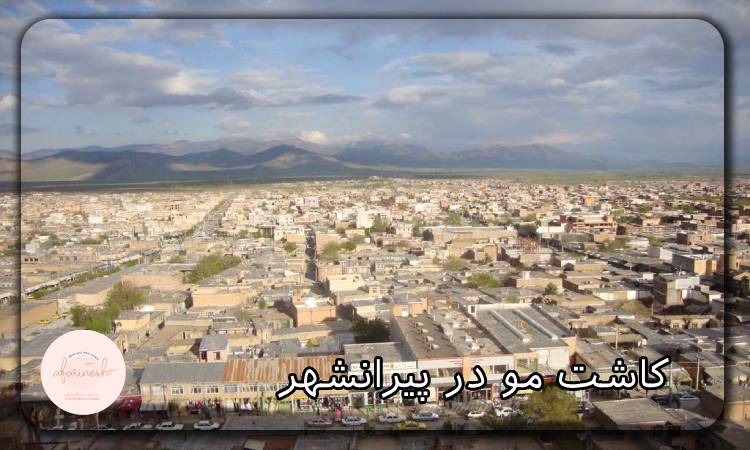 کاشت مو در پیرانشهر