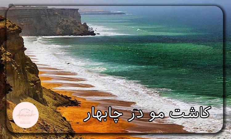 کاشت مو در چابهار