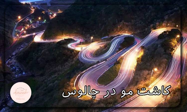 کاشت مو در چالوس